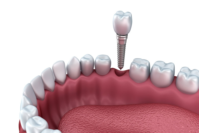 All the Place about Dental Health and wellness for Your overal wellness